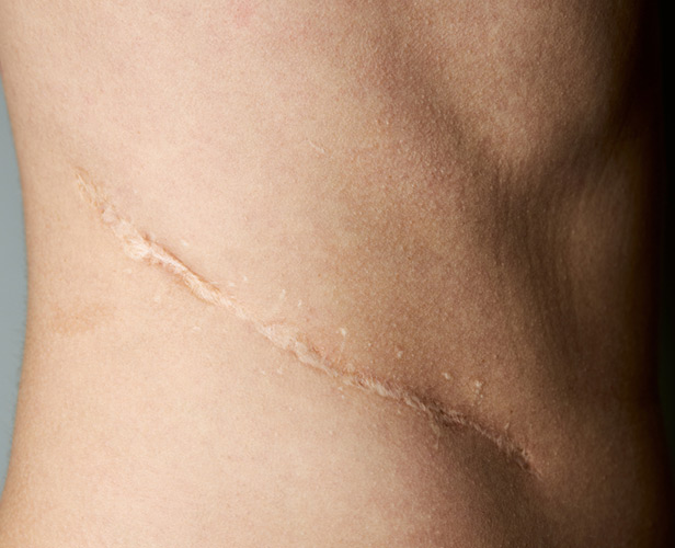 highlight-scarring highlight-scarring